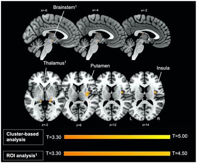 Investigating acoustic startle habituation and prepulse inhibition with silent functional MRI and electromyography in young, healthy adults